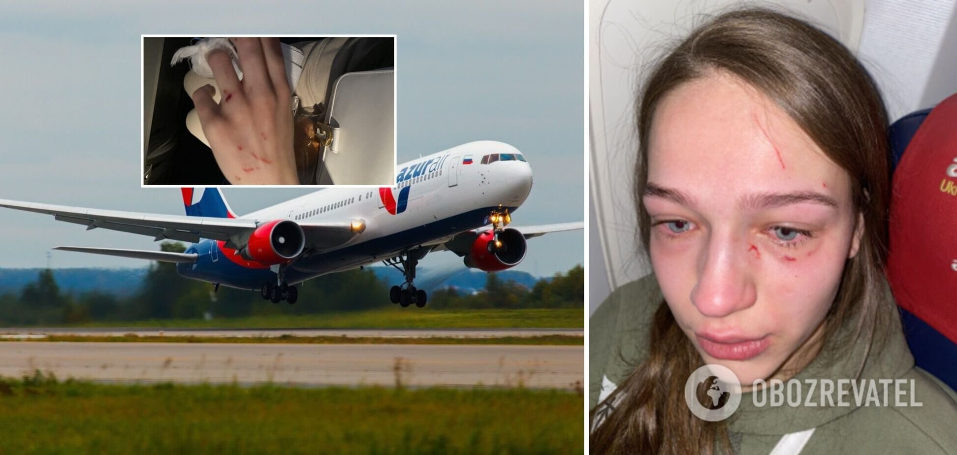 Расцарапала лицо, погрызла руку и откусила ноготь – в самолете из-за конфликта напали на украинку.ФОТО